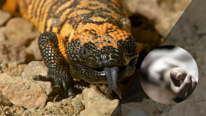 man passed away from a Gila monster bite